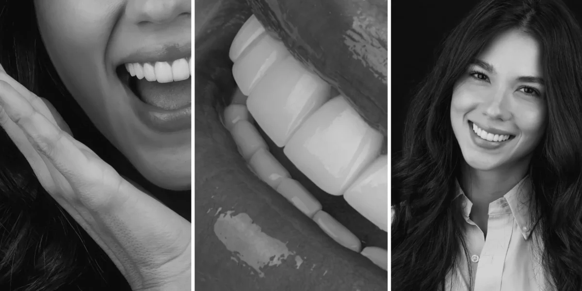Dra Diana Pulgarin Dental Group Diseño de sonrisa: lo que conviene saber antes de dar el paso  Image of Header 2 1200x600 Diseño de sonrisa