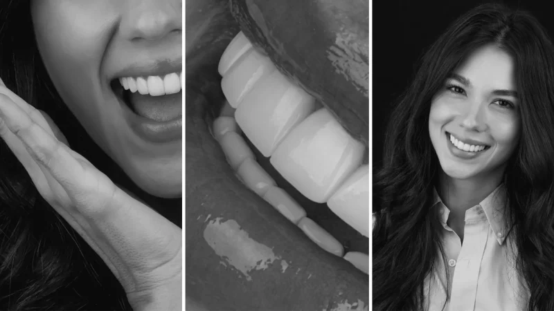 Dra Diana Pulgarin Dental Group Resina o cerámica: cómo elegir el material de su diseño de sonrisa  Image of Header 2 800x450 Diseño de sonrisa